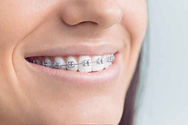 Best Full Mouth Reconstruction  in Lake Dallas, TX